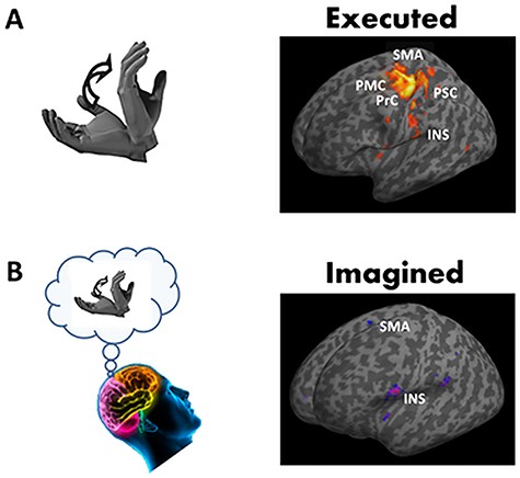 Brain areas activated during motor execution (A) and during motor imagery of hand movements (B) compared to rest. Brain responses are projected onto the inflated T1 template of MNI. Most significant brain responses are highlighted in the primary motor cortex (PMC) and the primary somatosensory cortices (PSC), in the premotor cortex (PrC) and the supplementary motor area (SMA), and the insular cortex (INS).