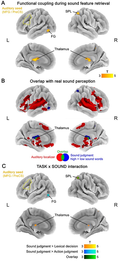 (A) Functional coupling with the auditory seed (left MFG/PreCS) during sound feature retrieval (sound judgments: high > low sound words). (B) Overlap (green) between functional coupling with the auditory seed during sound feature retrieval (blue) and activation for the auditory localizer (red; real sounds > silence). (C) TASK × SOUND interaction in functional coupling with the auditory seed, reflecting a stronger coupling increase for sound features (high vs. low sound words) during sound judgments than during lexical decisions (yellow), action judgments (blue), or both (green). All statistical maps were thresholded at a voxel-wise P < 0.001 and a cluster-wise P < 0.05 FWE-corrected.