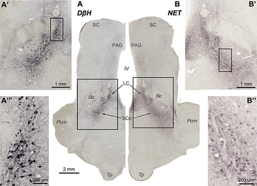 Pictures from brainstem slices through the coronal plane, immunoprocessed to reveal the 2 markers used in this work: DβH (A, A′, and A″) and NET (B, B′, and B″). Rectangles represent fields shown at higher magnification. Note that putative noradrenergic neurons are stained in the locations where NA neurons have been previously described, and not elsewhere. The contrast is higher in the neuronal bodies immunostained for DβH than in the neuronal bodies immunostained for NET, possibly due to the characteristics and cellular location of the markers. Importantly, both markers show selectivity for NA cells.