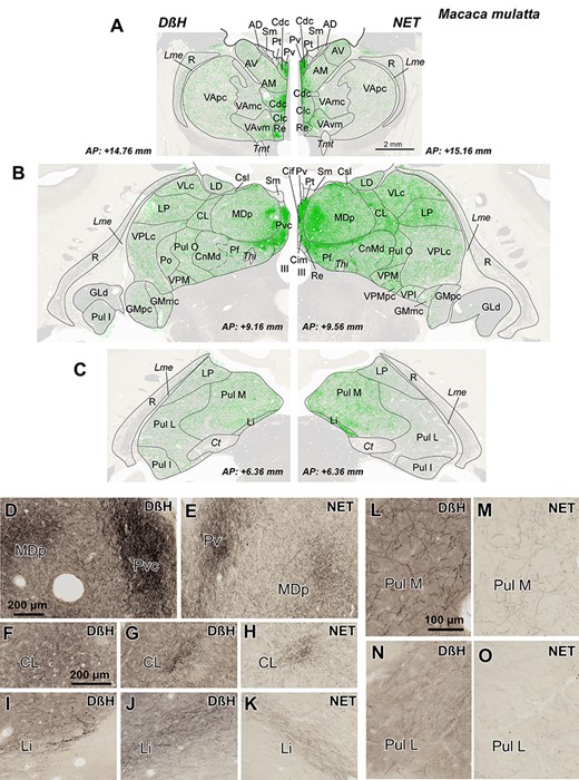 A–C) Distribution of NA axons (green) in 3 representative coronal sections of the M. mulatta thalamus, revealed by DβH (left) and NET (right) immunostaining. Note that the distribution patterns are very similar, independently of the marker used: the midline nuclei, the intralaminar nuclei (particularly Pf nucleus), and the medial sector of MD are the most innervated regions. NA axons are represented over attenuated photographs of adjacent sections stained for AChE, which were used to identify the nuclear borders. The stereotaxic anteroposterior (AP) level is indicated for each section. D–O) Pictures from immunostained sections allowing comparison between DβH and NET immunohistochemistry. Note that DβH immunostaining gives a higher contrast, but the distribution is similar for both markers. D,E) Dense patches present in Pv and MDp; microscopic fields from maps in B. F–H) Dense innervation in CL nucleus taken from the DβH map in B (F), from NET map in B (H), and from a section in a slightly different rostrocaudal level from the same animal, where DβH immunostaining in CL is more comparable to the one shown for NET immunostaining in B and H (G). I–K) Labeled-ir axons in Li nucleus taken from the DβH map in C (I), from NET map in C (K) and from a DβH immunostained section in a different animal, at a rostrocaudal level comparable to that of K (J). Note that, in I, as in C (left), the NA innervation of Li nucleus is near the posterior end of the nucleus, whereas the density patterns in C (right), J, and K are comparable between the 2 markers. Pictures of Li in I-K are shown as specular images for DβH and NET immunostaining to facilitate comparison with the maps in C. L–O) Microphotographs from Pul M and Pul L showing a higher innervation in Pul M. The calibration bars are common for A-C, D-E, F-K, and L-O. See the list of Abbreviations for identification of each thalamic nucleus.