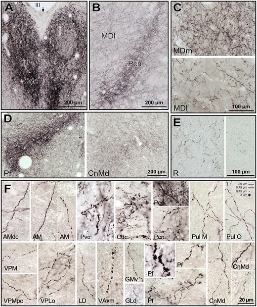 Microphotographs from histological sections of M. nemestrina, processed for DβH immunohistochemistry, from which the maps in Fig. 4 were obtained. A) Midline nuclei, mainly Pv and a portion of Cdc in the lower part. The arrow points to the midline. B) Anterior intralaminar nucleus Pcn, and rostral part of MDl. Note in A) and B) the dense innervation in Pv, Cdc and Pcn even at low magnification. A) and B) were taken from the histological section corresponding to the map in Fig. 4C. C) Comparison of the NA axon densities in 2 different regions of MD, with MDm having a denser innervation than MDl (pictures taken from section in Fig. 4D). D) Low magnification pictures of the posterior intralaminar CnMd-Pf complex, where the dense innervation in posterior Pf is in contrast with the moderate innervation in CnMd (from section in Fig. 4E). E) Microphotographs of R in 2 different fields. The one on the left is taken from a dorsal region of the section in Fig 4D; and the one on the right from a ventral region of the section in Fig 4F. F) High magnification pictures from a variety of nuclei, where different axonal morphologies are represented. Note the general varicose morphology, with the thicker varicosities present in midline nuclei (Pvc, Cdc), Pf, and VAvm. In general, intervaricose segments were thin, with calibers ranging from 0.5 to 0.75 μm; sometimes the intervaricose regions of the axons were unidentifiable (e.g., VAvm). Varicosities ranged from 0.5 to 3 μm. In the upper right corner, scaled lines and dots with the mentioned calibers are depicted, for comparison with the microphotographs. See list of Abbreviations for identification of each thalamic nucleus.