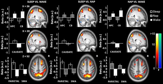Significant brain activations in the sleep vs. wake, sleep vs. nap and nap vs. wake contrasts from training to retest. Changes in activation in the hippocampus and cerebellum (first row), the caudate (second row), and in the parietal and supplementary motor cortices (third row) are shown with corresponding contrast estimates (beta values in arbitrary units; a.u.) and 95% confidence intervals for the magnitude of the HRF. Warm colors reflect increases in activation and cool colors reflect decreases in activation. Abbreviations: hippocampus (HPC); cerebellum (CB); supplementary motor area (SMA).