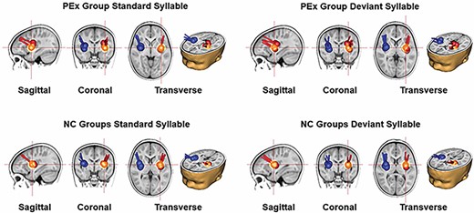 乳幼児が短い聴覚的手がかりに触れることは言語発達をサポートする可能性がある(Infant Exposure to Brief Auditory Cues Can Support Language Development) 乳幼児が短い聴覚的手がかりに触れることは言語発達をサポートする可能性がある(Infant Exposure to Brief Auditory Cues Can Support Language Development)