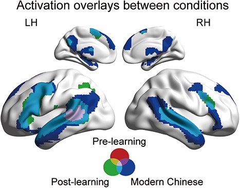 Whole brain activation during modern Chinese story listening, pre-learning Classical Chinese story listening, and post-learning Classical Chinese story listening. Each activation plot was thresholded at voxelwise P < 0.001, FWE-corrected cluster-level P < 0.05.