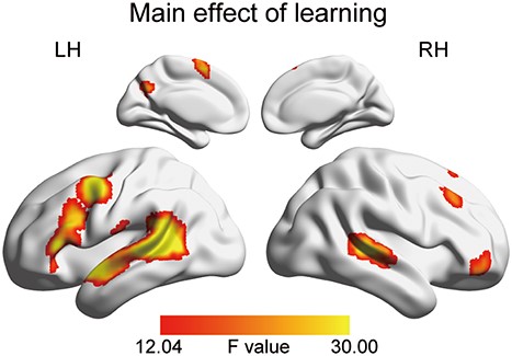Whole-brain results of the main effect of learning. The activation map was thresholded at voxelwise P < 0.001, FWE-corrected cluster-level P < 0.05.