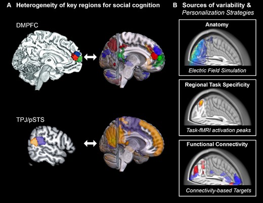 Heterogeneity of regions and personalization strategies. A) Parcellations of two key regions involved in social cognition, DMPFC and TPJ, based on dissociable fMRI co-activation patterns. Subregion-specific functional connectivity patterns are shown to the left of each parcellation. The data for the illustrations were shared with friendly permission (Bzdok et al. 2013; Eickhoff et al. 2016). B) Schematic example of strategies accounting for intersubject variability for NIBS on the single-subject level. Top: Optimal extracranial device positions and required stimulation intensities can be estimated based on individual anatomy. Middle: Intracranial target may be defined by task-specific activation or, bottom: by connectivity to a predefined network of interest.