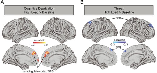 Associations between cognitive deprivation (A) and threat (B) with neural activation during high load WM vs. baseline. Cognitive deprivation and threat were included in the same model with covariates for age and sex. SFG: superior frontal gyrus.