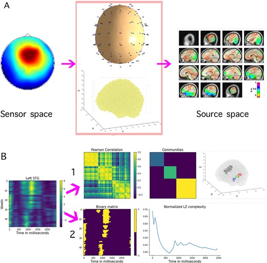(A) Visualization of power time-series projection to source space (left column). Sensor level signals are projected using a standard MNI model and realistic positions of the electrodes (middle column). The $xyz$ coordinates of the 3D grid correspond to values in the axial, sagittal, and coronal planes, respectively. The resulting matrix has power values in MNI space (right column), where we display changes relative to mean power, here expressed in arbitrary units (a.u.). (B) Matrix of power time-series in left STG (49 voxels $\times $ 50 time points). (1) Visualization of the community detection process: Pearson correlation of the time-series (49$\times $49 matrix), the three communities detected and the corresponding 49 voxels in STG showing the functional parcellation (the voxels of the right STG are also highlighted in black color for visualization purposes). (2) Graphical representation of the normalized LZ complexity computation: binary matrix obtained by thresholding the signals with 1 SD and the evolution in time of the LZ measure in time, normalized by its entropy at each time instant.