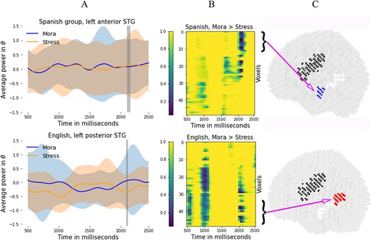 Top row: results for the Spanish participants. (A) Mean power in theta range in the anterior STG, averaged across subjects and trials. (B) $P$-value map for the comparison mora > stress. (C) voxel localization in MNI space. Bottom row: results for the English participants. (A) Mean power in theta range in the in the posterior STG, averaged across subjects and trials. (B) $P$-value map for the comparison mora > stress. (C) Subgroup the voxel belongs to in MNI space.