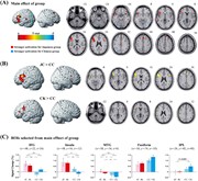 (A) Brain regions showing significant effects of group in the ANOVA analysi...