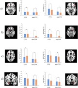 Group differences in activation between low- and high-indole stimuli in a) ...