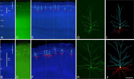 Confocal microscopy images of human neurons injected with LY in occipital BA17 cortex (top images) and temporal BA20 cortex (bottom images). A and B) DAPI staining to illustrate cortical thickness (white bars) and estimated values (in microns) in A occipital and B temporal (top: BA20; bottom: BA21) cortex. Blue bars indicate the approximate position of labeled neurons apical arbors. White stars represent the initiation of the apical tuft. C and D) Labeled pyramidal neurons in layer IIIa of the region shown in A and B. E and F) 3D reconstructed neurons superimposed on the DAPI staining showing apical (light blue) and basal (red) arbors. Apical tufts, if present (white stars), were found to initiate within layer II (highlighted in white lines). Boxed area corresponds to regions shown in A to D. G and H) High magnification image z projection showing an injected G) BA17 and H) BA20 pyramidal cell. I and J) 3D reconstruction of the same neurons shown in G and H. Incomplete dendritic segments are highlighted in white. Scale bar (in J) = 500 μm in A to F, and 100 μm in G to J.