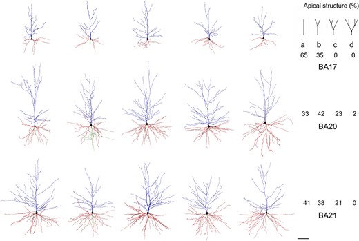 Example drawings of the apical (blue) and basal (red) dendritic arbors of human BA17 (top), BA20 (middle), and BA21 (bottom) pyramidal neurons. Axons, if present, are shown in green. On the right, the corresponding prevalence percentage of the different main apical branching patterns (top right): a) 0 bifurcations; b) 1 bifurcation; c) 2 bifurcations; d) 3 bifurcations—within the first 200 μm—is shown in each cortical region. Scale bar = 100 μm.