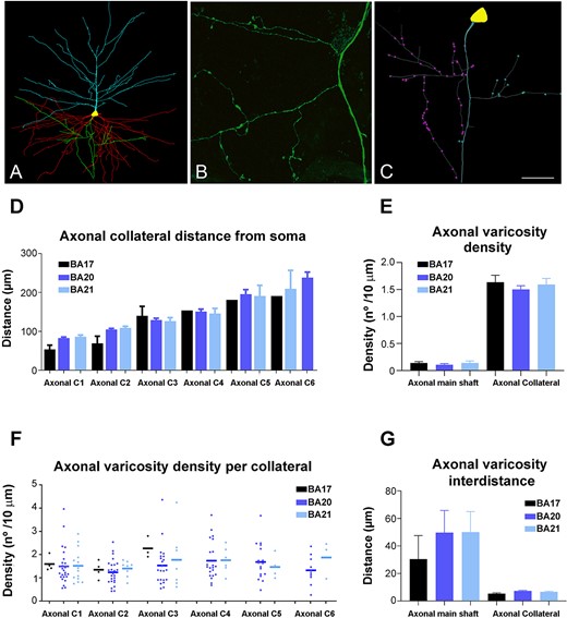A) 3D pyramidal cell reconstruction (apical: blue; basal: red; axon: green) from BA20. B) High magnification confocal microscopy image from BA20 to illustrate axonal boutons. C) 3D reconstructed axon from the cell shown in A illustrating the main axonal shaft and axonal varicosities from collateral 1 (purple) and collateral 2 (blue). D–G) Graphs showing the mean distance from soma of the D) axonal collaterals, E) mean axonal varicosity density, F) mean axonal varicosity density per collateral, and G) mean axonal varicosity interdistance in the main axonal shaft and in the axonal collaterals (C1-6) from human BA17, BA20, and BA21 cortical areas. Scale bar (in C) = 100 μm in A, 17 μm in B, and 40 μm in C.