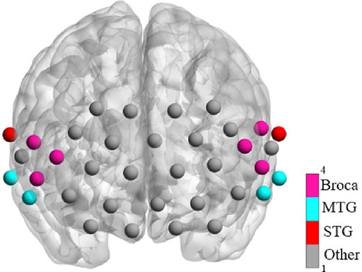 The measurement ROIs used in this study and the corresponding brain areas.