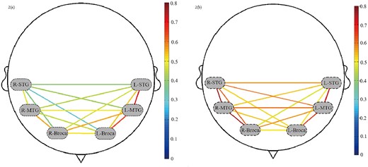 RSFC of ROIs: a) and b) represent the RSFC of ROIs of male and female group respectively. The dashed ovals signify 6 ROIs. The redder lines represent stronger RSFC between the ROIs, and the bluer ones represent the weaker RSFC between the ROIs.