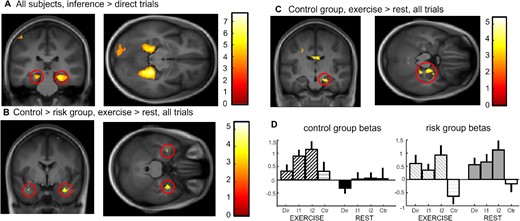 Imaging results at test. (A) Inference 2 and inference 1 trials versus direct trials for both groups and both exercising conditions showing bilateral parahippocampal and hippocampal activation. (B) Interaction control vs risk for exercise vs. rest conditions across all associative memory trials showing bilateral medial temporal lobe activation. (C) Effect of exercise versus rest across all associative memory trials for the control group showing right hippocampal activation at 20, −16, −20. (D) Beta values for the hippocampal activation in (C) for each trial type and Exercising Condition separately showing a clear difference between conditions in the control group but a similarly high hippocampal activity in both exercise and rest for the risk group.