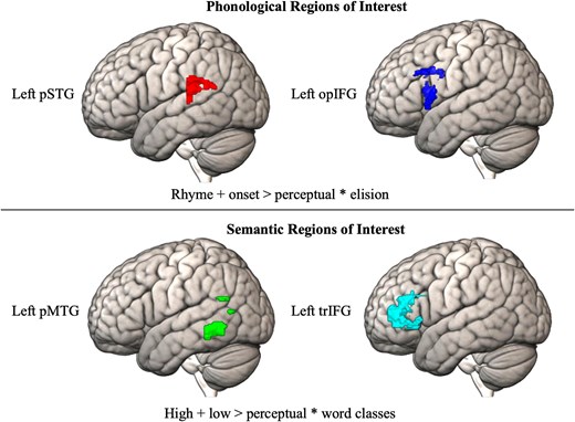 Top 500 voxels for sound and meaning tasks. Activation during the sound and meaning tasks was correlated with the behavioral tasks for phonology and semantics (elision/word classes). The top 500 activated voxels for this contrast within each of the anatomical regions of interest were extracted. Anatomical regions of interest were the left posterior superior temporal gyrus (pSTG) and left inferior frontal gyrus opercular (opIFG) for phonological processing and the left posterior middle temporal gyrus (pMTG) and left inferior frontal gyrus triangularis (trIFG) for semantic processing. These top 500 voxel masks then constituted our functional localizers for phonological (pSTG and opIFG) and semantic (pSTG and trIFG) processing.
