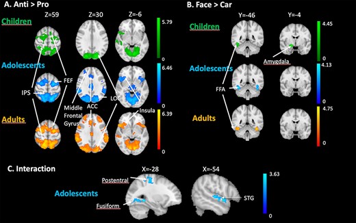(A) Whole brain univariate results for the production of correct antisaccades (anti vs. pro) in children, adolescents, and adults. (B) Whole brain univariate results for viewing faces (proFace vs. proCar) in children, adolescents, and adults. (C) Whole brain univariate results for the task × stimulus interaction in adolescents. The contrasts are displayed at a threshold using clusters determined by Z > 2.3 and a (corrected) cluster significance threshold of P = 0.05.