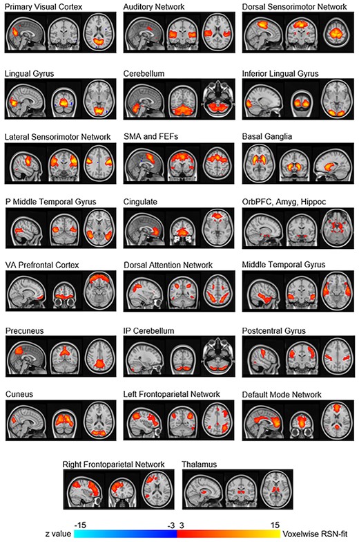 Resting state networks that were visually identified based on placebo session data. These 23 networks were averaged components from the 10 gICAs. SMA and FEFs: Supplementary motor area and frontal eye fields; P Middle Temporal Gyrus: Posterior middle temporal gyrus; OrbPFC, Amyg, Hippoc: Orbitofrontal prefrontal cortex, amygdala, and hippocampus; VA Prefrontal Cortex: Ventral anterior prefrontal cortex.