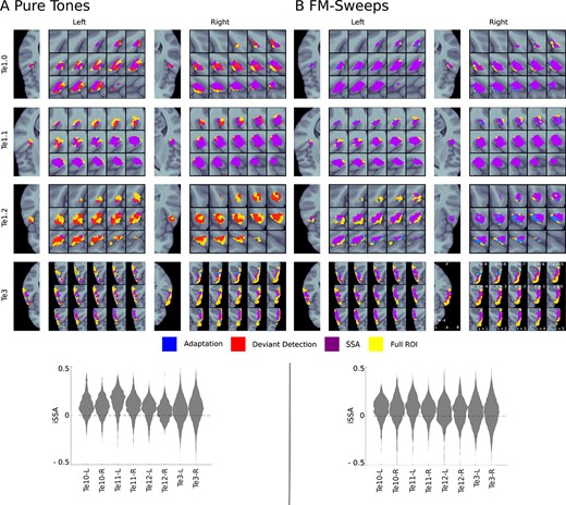 Adaptation, deviant detection, and SSA regions. Upper panels: voxels exhibiting significant ($P < 0.05$, FDR-corrected) adaptation (blue indicates adaptation alone, purple indicates SSA which entails adaptation), deviant detection (red indicates deviant detection alone, purple indicates SSA which entails deviant detection), and SSA (purple) are shown for each anatomical ROI (yellow). Lower panels: Distributions of SSA magnitude in all anatomical ROIs; we found very similar distributions in all ROIs and for both stimulus types. (A) Pure tones; (B) FM-sweeps.