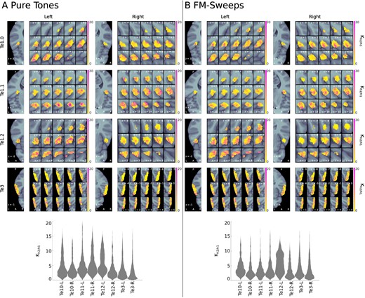 Bayes’ $K_{h2/h1}$ for pure tones and FM-sweeps. The upper panels show $K_{h2/h1}$ in each voxel of the anatomical ROIs; the lower panels show the distribution of $K_{h2/h1}$ across all voxels of the anatomical ROIs. (A) Pure tones; (B) FM-sweeps. The results indicate evidence in favor of the prediction error model (h2) in most voxels of all anatomical ROIs for both stimulus types.