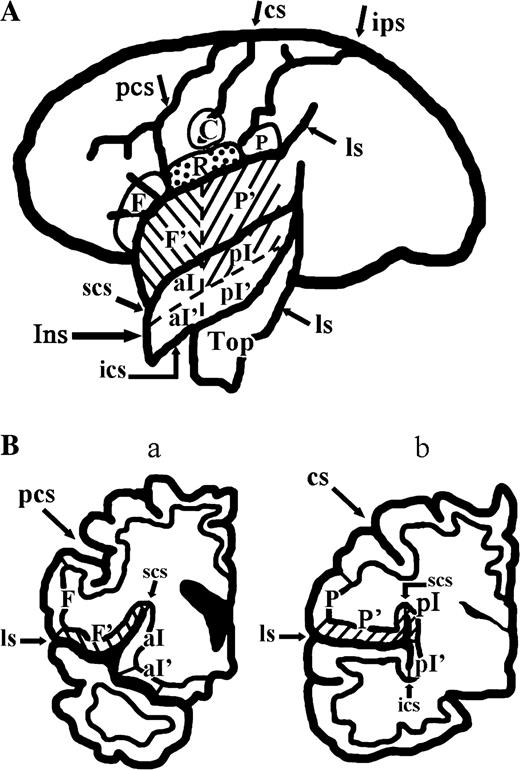 Locations of ROI. (A) Development of the lateral sulcus to show the ROIs at the operculum and insula together with those at the external surface of the cerebral hemisphere. (B) (a) and (b) show two coronal planes through the Fop and Pop, respectively. Hatched area represents area G; reversely hatched area, the Fop; and dotted area, the Rop, but the ventral end of the central operculum is not marked. C, Ventral end of the central sulcus; F, exposed part of the Fop; F′, buried part of the Fop; P, exposed part of the parietal operculum; P′, buried part of the Pop; R, Rop; Top, temporal operculum; aI, superior anterior insula; aI′, inferior anterior insula; pI, superior posterior insula; pI′, inferior posterior insula; cs, central sulcus; ips, intraparietal sulcus; ls, lateral sulcus; ics, inferior circular sulcus of the insula; scs, superior circular sulcus of the insula.