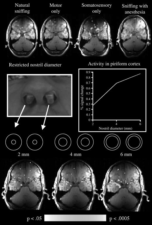 Influence of sniffing on fMRI signal in piriform cortex. Top row from left to right: magnetic resonance activity induced by natural sniffing, by trying to sniff with the nostrils occluded, by artificial airflows directed at the nostrils, and by sniffing with topical anesthesia in the nostrils. Middle row from left to right: the implants used to restrict nasal flow and the effect of this on fMRI signal in piriform cortex. Bottom row: the corresponding activation patterns. Taken together, these results demonstrated that activity in primary olfactory cortex is strongly affected by the somatosensory stimulation of sniffing (Sobel et al., 1998a).