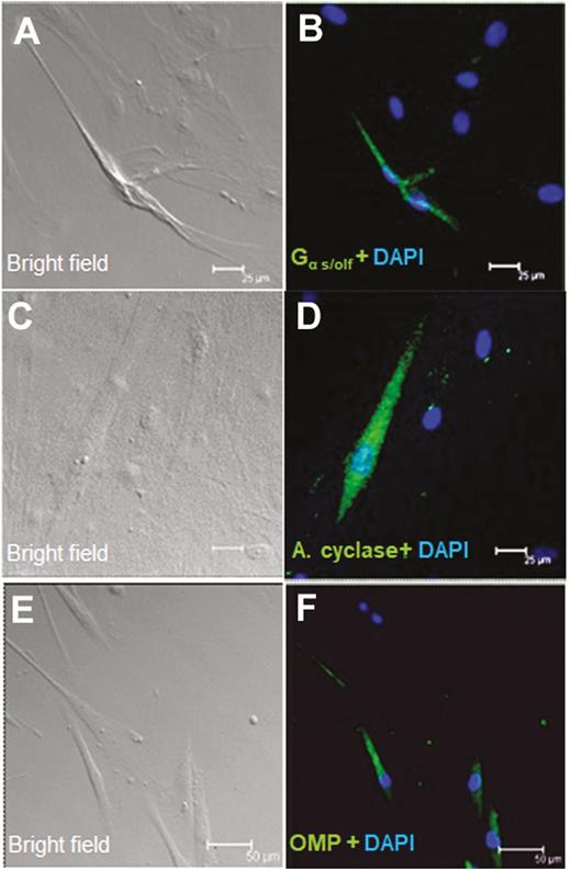 Immunocytochemical detection of olfactory signal transduction proteins in HBO cells. Brightfield (A, C, and E) and immunofluorescence (B, D, and F) images demonstrate immunoreactivity (green) of Gα s/olf (A and B; n = 15 of 72) in the cytoplasm and membrane and of adenylyl cyclase (C and D; n = 23 of 217) and OMP (E and F n = 13 of 92) in the cytoplasm in a subgroup of HBO cells. Nuclei are stained with DAPI (blue). Scale bars: (A–D) = 25 µm; (E) and (F) = 50 µm.