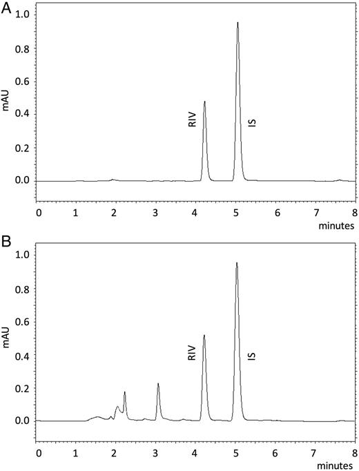Chromatograms taken under the optimum conditions. (A) RIV standard solution (3.75 µg mL−1) and (B) RIV spiked into plasma as 0.5 µg mL−1.