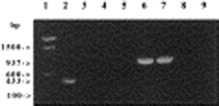 Detection of the luk-PV genes (lanes 2–5) and hlg (lanes 6–9) by polymerase chain reaction and analysis by 1.5% agarose gel electrophoresis. Lane 1, molecular weight marker; lanes 2 and 6, strain ATCC 49775 (lukS-PV+, lukF-PV+, hlgA+, hlgC+, hlgB+); lanes 3 and 7, strain Newman (lukS-PV-, lukF-PV-, hlgA+, hlgC+, hlgB+); lanes 4 and 8, strain N65 (lukS-PV-, lukF-PV-, hlgA-, hlgC-, hlgB-); lanes 5 and 9, H20.