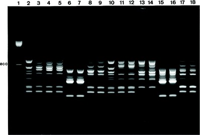 Randomly amplified polymorphic DNA fingerprint patterns obtained for Acinetobacter baumannii blood isolates after PCR amplification with M13 primer showing representative isolates of the following different A. baumannii strain types: types a (lanes 3–5), b (lanes 6 and 7), c (lanes 8 and 9), d (lanes 11 and 12), e (lanes 13 and 14), f (lanes 15 and 16), and g (lanes 17 and 18). Lane 1, 100-bp ladder. Lanes 2 and 10, internal A. baumannii reference strain. For origin of strains, see table 3.
