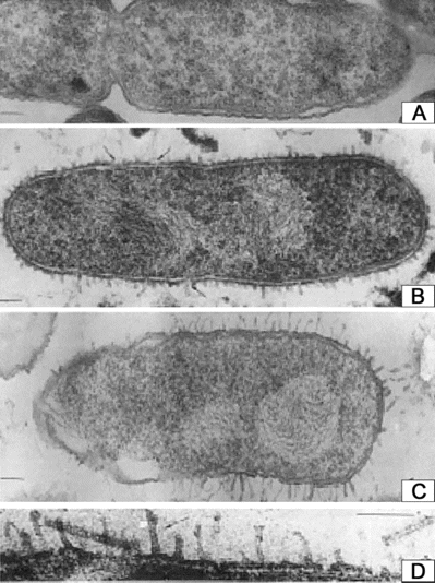 Sections of a Pseudomonas aeruginosa strain showing the alterations in the cell following the administration of polymyxin B (25 µg/mL for 30 min) and colistin methanesulfate (250 µg/mL for 30 min). (Provided with permission from the American Society for Microbiology). A, untreated cell; B, cell treated with polymyxin B; C, cell treated with colistin methanesulfate; D, cell treated with polymyxin B (from panel B) at higher magnification. Bar = 0.1 µm.