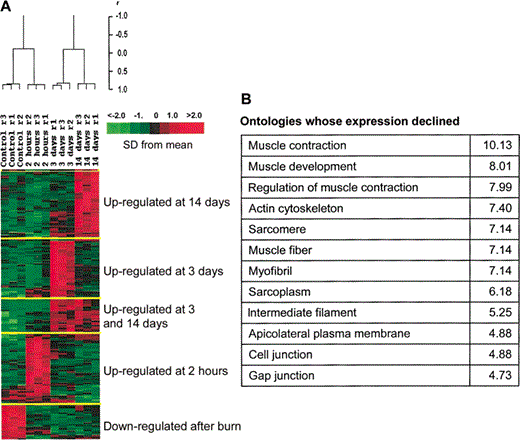K-means cluster analysis of gene expression andgene on tologies in murineskin following a second-degreeburn injury. A, Asecond-degree scald burn altered the expression of 192genes, and the patternscould be reduced togenes whose expression either was reduced over theentire 14 days orwas increased at intervalsover the 14 days.B, Selected gene ontologies whose expression decreased after the burn injury. Alsoprovided are z scores,which quantitate the relativelikelihood that a specificontology is overrepresented than would occur by chancealone. Figure is modifiedfrom Feezor et al.[30].
