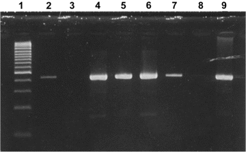 Ethidium bromide stain of 2% agarose gel showing RT-PCR products (443 bp) of partial coronavirus N gene with human coronavirus HKU1—specific primers. Lane 1, size marker (100 bp); lanes 2, 4–7, and 9, positive respiratory samples; lanes 3 and 8, negative control RT-PCR mix.