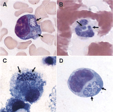Ehrlichia chaffeensis (A and C; Wright stain) and Anaplasma phagocytophilum (B and D; Hema-3 stain) morulae (arrows) in peripheral blood monocytes (A), peripheral blood neutrophils (B), DH82 canine histiocytic cell culture (C), and human HL-60 promyelocytic cell culture (D). Original magnification, ×260. (Panel A courtesy of A. Marty.)
