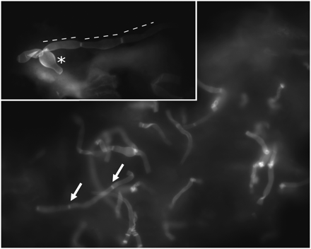 Calcofluor white mainly stains the chitin of the fungal cell wall. Morphologic characteristics are those of Candida albicans, including septated mycelium (white arrows), germinating yeast cells (asterisk), and pseudomycelium (dashed lines). The formation of the characteristic chlamydospores is not to be expected under these conditions (original magnification ×400, insert upper left: original magnification ×1000).