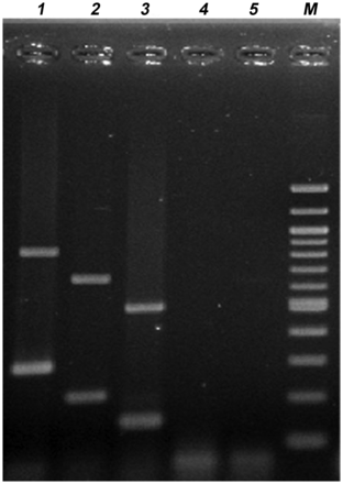 Appearance of diarrheagenic Escherichia coli amplicons separated by agarose gel electrophoresis. Lane 1, enteropathogenic E. coli; lane 2, enteroaggregative E. coli; 3, enterotoxigenic E. coli; lanes 4 and 5, negative control strains; lane 6, 100 bp DNA ladder (New England Biolabs).
