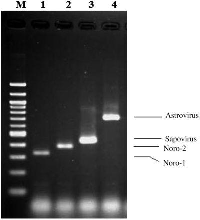 Appearance of enteric viral amplicons separated by agarose gel electrophoresis. Lane M, 100 bp DNA ladder (New England Biolabs); lane 1, Norovirus GI (330 bp); lane 2, Norovirus GII positive (387 bp); lane 3, sapovirus (434 bp); lane 4, astrovirus (719 bp).