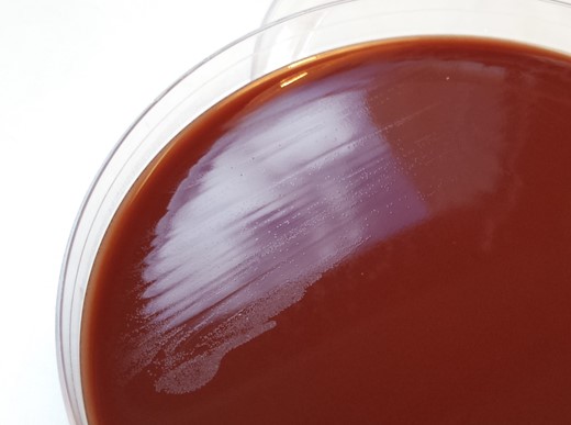 Small translucent colonies on chocolate agar after 72 hours in 5% carbon dioxide at 37°C.
