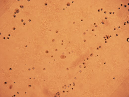 Colony morphology of isolate from periprosthetic tissue, after 24 hours of anaerobic incubation on specialized agar.
