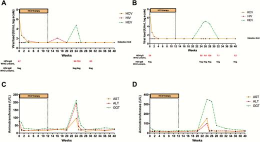 Hepatitis C virus (HCV), human immunodeficiency virus (HIV), and hepatitis E virus (HEV) viral load during HCV therapy and follow-up in case 1 (A) and case 2 (B). The reverse-transcription polymerase chain reaction detection limit for HCV, HIV, and HEV was set at 15 IU/mL, 20 IU/mL, and 25 copies/mL, respectively. Anti-HEV IgG and IgM antibodies were determined using the Wantai Diagnostic enzyme-linked immunosorbent assay kit. Aspartate aminotransferase, alanine aminotransferase, and γ-glutamyl transferase during HCV therapy and follow-up in case 1 (C) and case 2 (D).