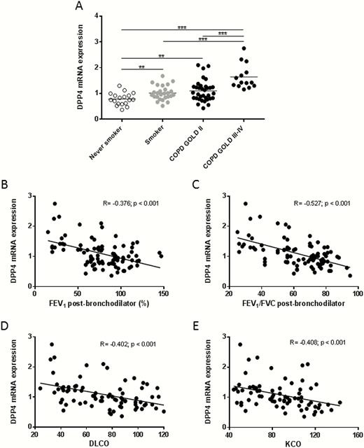 DPP4 mRNA expression in the lung tissues of smokers and COPD patients. A, DPP4 mRNA expression was measured by qRT-PCR and normalized to three reference genes (GAPDH, HPRT-1, SDHA). DPP4 mRNA expression in the lungs of smokers and COPD patients is significantly higher in comparison to that of never smokers. B, Correlation of DPP4 mRNA expression with post-bronchodilator FEV1 values. C, Correlation of DPP4 mRNA expression with post-bronchodilator Tiffeneau index (FEV1/FVC). D, Correlation of DPP4 mRNA expression with DLCO (diffusing capacity or transfer factor of the lung for carbon monoxide). E, Correlation of DPP4 mRNA expression with KCO (carbon monoxide transfer coefficient). **P < .01, ***P < .001. Abbreviations: COPD, chronic obstructive pulmonary disease; DLCO, diffusing capacity of the lung for carbon monoxide; FEV/FVC, forced expiratory volume in 1 second/forced vital capacity; GOLD, global initiative for obstructive lung disease; KCO, transfer of carbon monoxide coefficient; mRNA, messenger RNA; qRT-PCR, quantitative reverse-transcription polymerase chain reaction.
