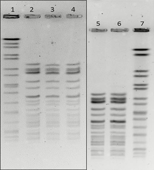 Pulsed-field gel electrophoresis results of involved isolates. Samples tested with corresponding case number: 1, standard; 2, case 2; 3, case 1; 4, case 3; 5, case 3; 6, case 4; 7, standard. The gels were run with different electrophoresis conditions to accommodate the daily workflow in the laboratory on different days; however, by running samples from case 3 along with case 4, we can see that the 2 samples match, which means that all cases have matching fingerprints, suggesting the same strain.