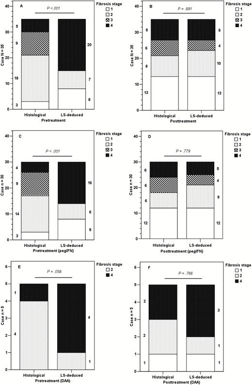 Comparisons between the pretreatment and posttreatment proportions, stratified by histological fibrosis stages and stiffness-deduced fibrosis stages. LS-deduced fibrosis staging was implemented by applying the following cutoff values (m/s): METAVIR fibrosis stage F1 versus F2–F4, F1–F2 versus F3–F4, and F1–F3 versus F4 by 1.47, 1.81, and 1.86 in the pretreatment group, respectively, and 1.22, 1.59, and 1.75 in the post-SVR group, respectively. (A, B) Total patients with paired biopsies (n = 35). (C, D) Patients who received pegIFN-based therapy (n = 30). (E, F) Patients who received DAA-based therapy (n = 5; numbers beside the plotted bars indicate the case number for each fibrosis stage). Abbreviations: DAA, direct-acting antiviral-based therapy; LS, liver stiffness; pegIFN, pegylated interferon–based therapy.
