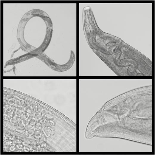 Morphologically identifying features of adult female Thelazia gulosa submitted for analysis. Top left: complete adult female worm; note torn intestine. Top right: anterior showing wide and deep buccal cavity, vulval opening, and esophageal-intestinal junction. Because of retraction of the esophagus and intestine anteriorly, due to the torn intestine, the vulval opening appears to be anatomically posterior to this junction. Bottom left: the mid body includes cuticular striations, intestinal tube, and ovaries containing spirurid eggs and larvae. Bottom right: the anal opening shows an absence of protrusion. (Original magnification ×200; Nomarsky phase contrast, and light microscopy.)