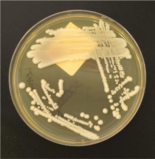 Sabouraud dextrose agar subculture from a positive aerobic blood culture demonstrating numerous 0.5- to 1-mm cream-colored glabrous colonies after 24 hours of incubation at 35°C.
