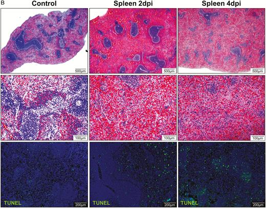 Representative histopathological changes of the intestine and spleen. A, H&E and immunofluorescence staining of intestinal tissue at 2 dpi. (a) Mock-infected hamster's intestine; (b) and (c) intestinal mucosal epithelia and Peyer’s patches of virus-challenged hamsters at 2 dpi; (d) a few mucosal epithelial cells and interstitial histiocytes were found weakly positive for viral NP (arrows); (e) epithelial cell necrosis and (f) viral NP expression (arrows) in the intestine at 4 dpi. B, Images of H&E- and TUNEL-stained spleen sections at 2 dpi and 4 dpi showing depletion of white and red pulps with reduced number and size of follicles and increased apoptosis. Abbreviations: dpi, days postinoculation; H&E, hematoxylin and eosin; NP, nucleocapsid protein; SARS-CoV-2, severe acute respiratory syndrome coronavirus 2; TUNEL, terminal deoxynucleotidyl transferase deoxyuridine triphosphate nick end labeling.