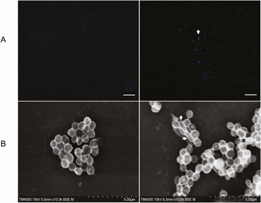 Microscopic detection of Methanobrevibacter smithii in 1 patient with mixed Staphylococcus aureus and M. smithii infective endocarditis (patient 11). A, Autofluorescent M. smithii methanogens in the blood were excited by an ultraviolet excitation laser, and image acquisition was performed with a Zeiss LSM 800 confocal microscope using a 63 X, 1.4 numeric aperture oil immersion objective. The scale bar represents 10 µm. B, Methanobrevibacter smithii methanogens in the blood were observed along with S. aureus using scanning electron microscopy with TM4000Plus software (Hitachi). All image settings for the magnification, focus, and keV mode are shown on micrographs. Scale bars represent 5 μm. Left panels, negative controls; right panels, patient’s blood sample.