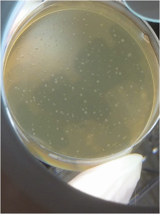Methanobrevibacter smithii colonies were isolated via culture from the blood of a 60-year-old febrile male (patient 7).
